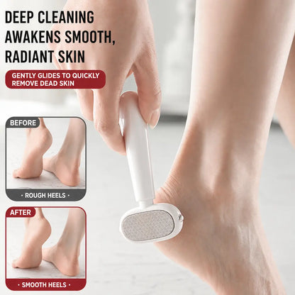 [Last Day Buy 1 Get 1 Free] Dual‑Sided Foot Callus Remover, Replaceable Stainless Steel Blade Foot Scraper🦶